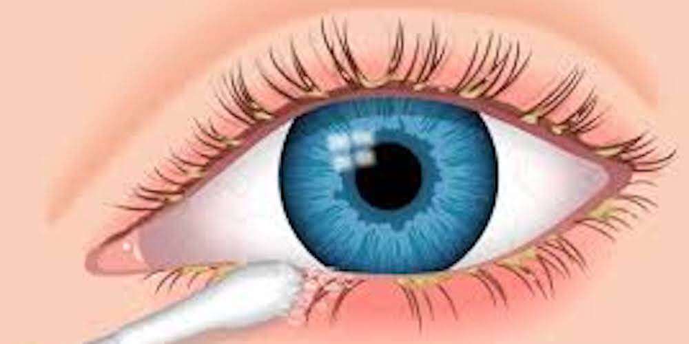 eyelash extension hygiene
